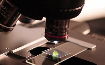 Qu’est-ce qu’un test de sensibilité alimentaire ?